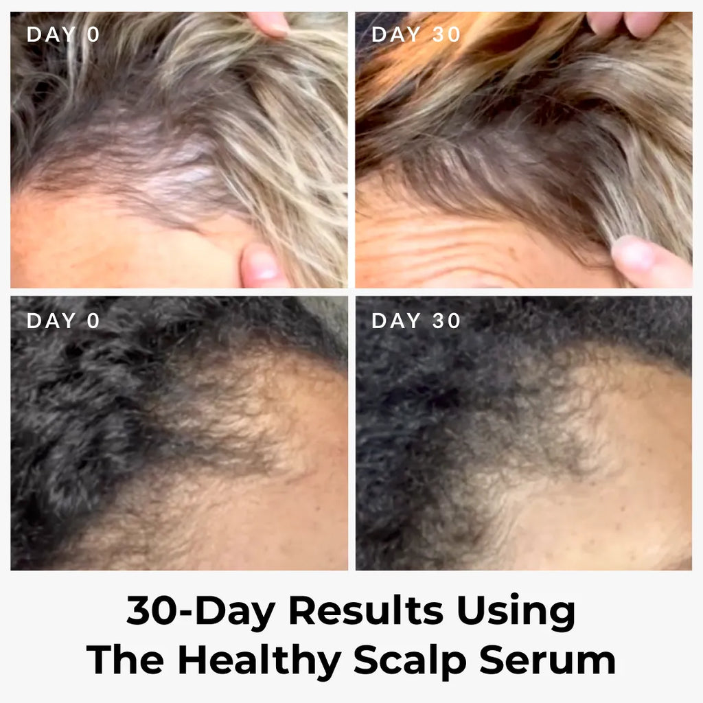 Healthy Scalp Serum