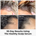 Healthy Scalp Serum