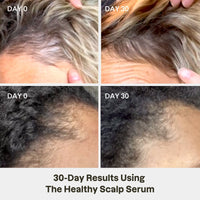 Healthy Scalp Serum