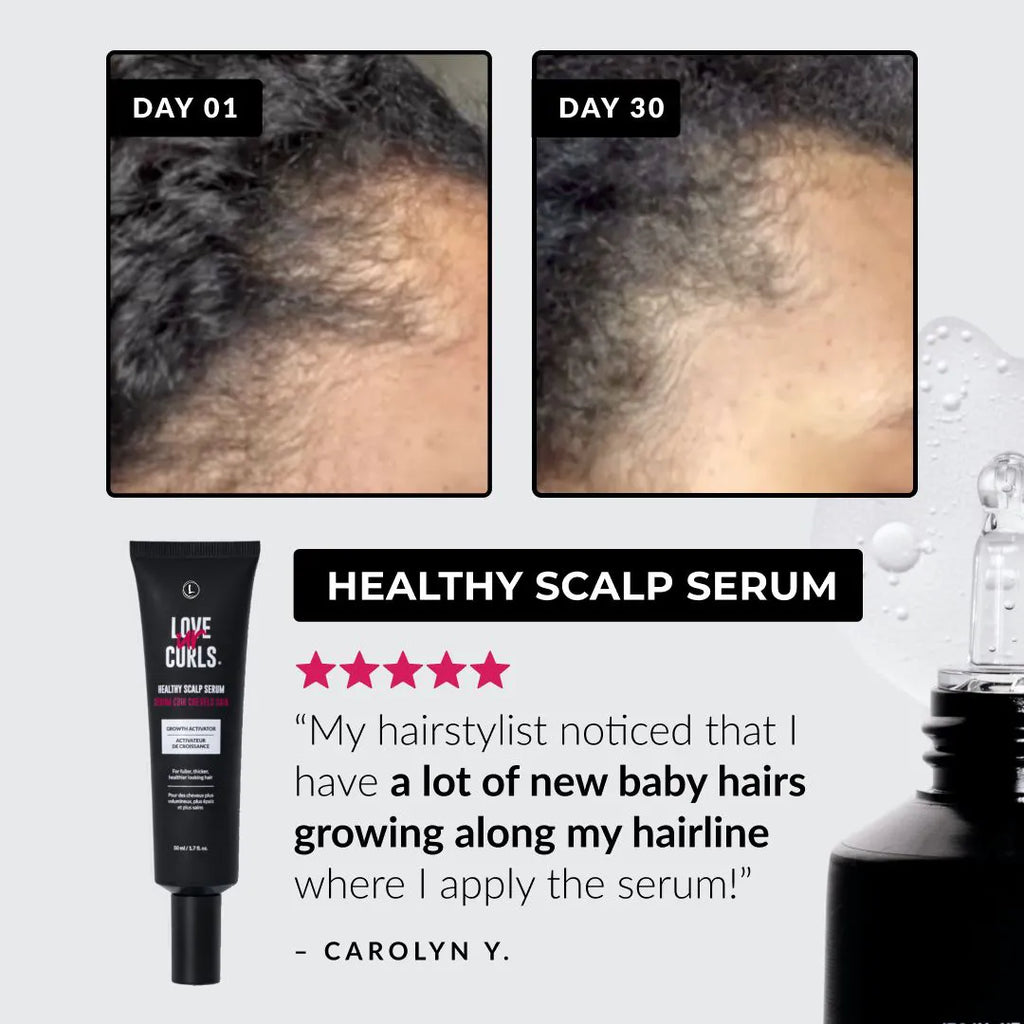 Before and after comparison of hair growth with a healthy scalp serum product on a light gray background.